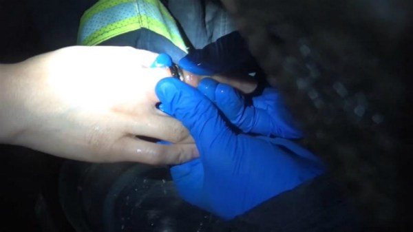 3万元戒指卡住女子手指 消防巧用洗洁精润滑