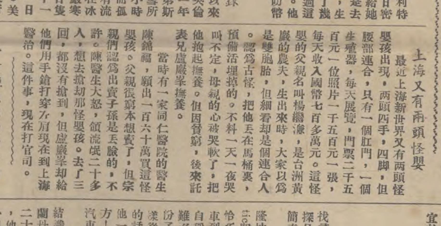 1947年上海老照片，“连体婴儿”展览事件始末