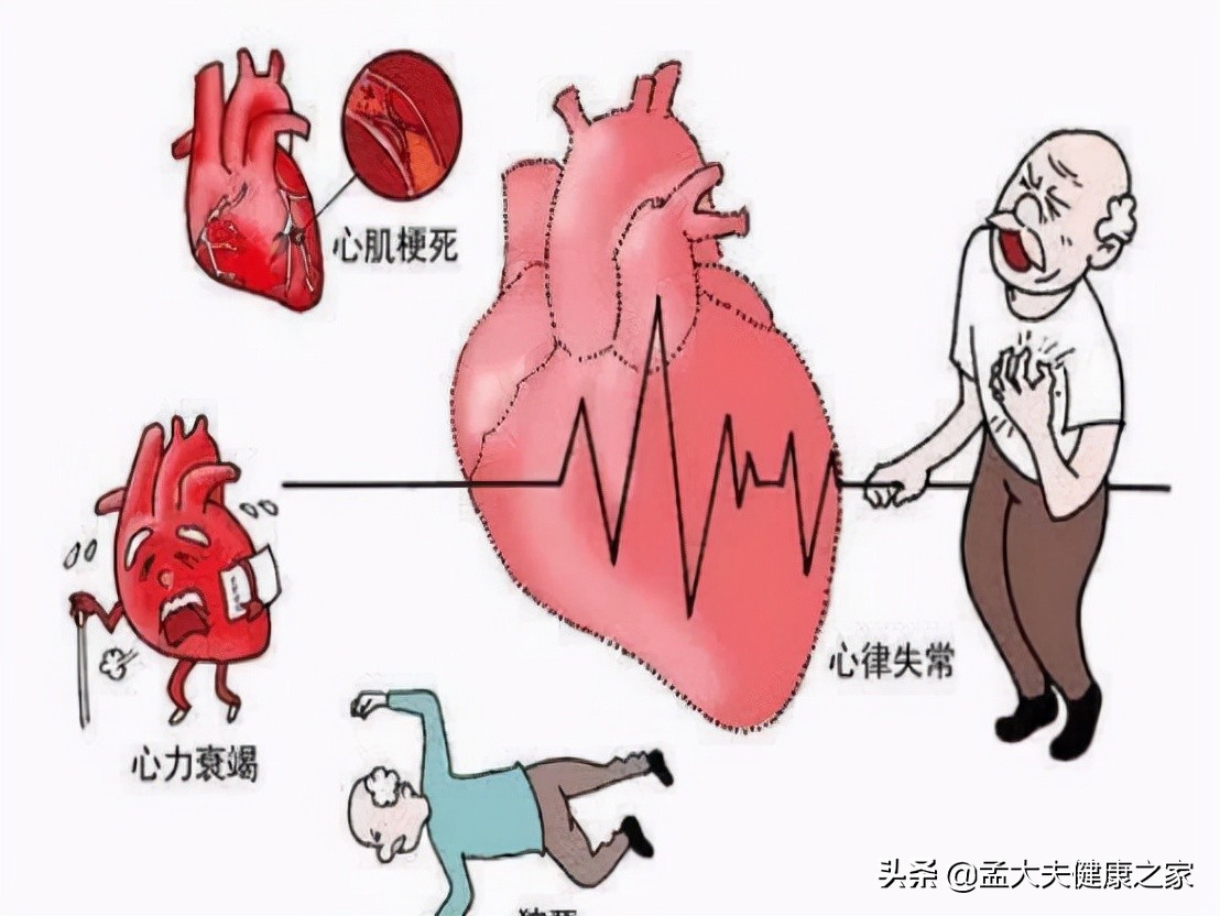 冠心病、心絞痛根在血脈不通，2個成藥理氣活血化瘀，保護心血管