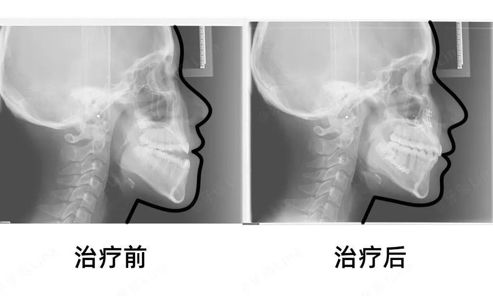 换头，了解一下？