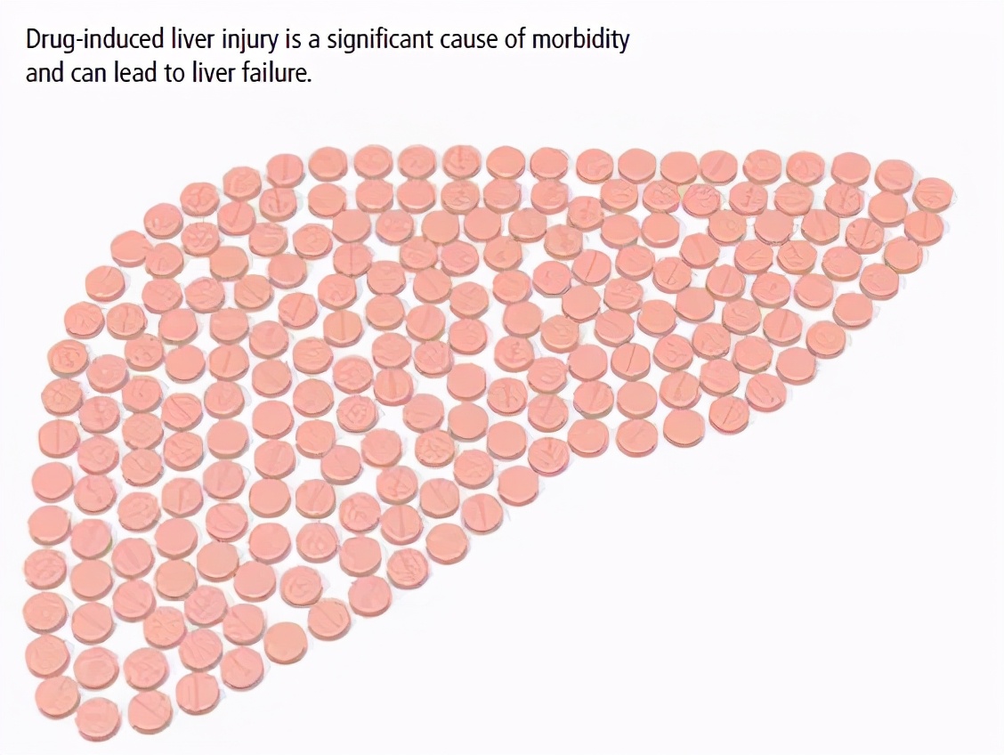 转氨酶高，该怎么办？如果你有肝损伤，请收下这篇雨露均沾的科普