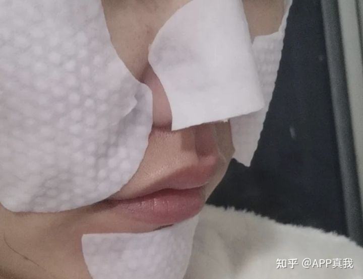 怎么才能消除闭口粉刺？看这里