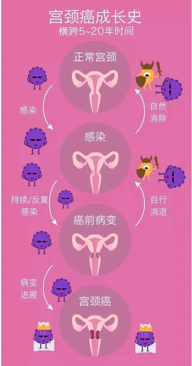 规范化筛查，远离宫颈肿瘤
