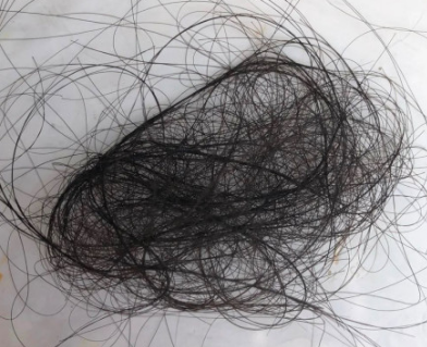 洗发水黑名单大吐槽，各个都是“脱发神器”, 难怪发际线上移