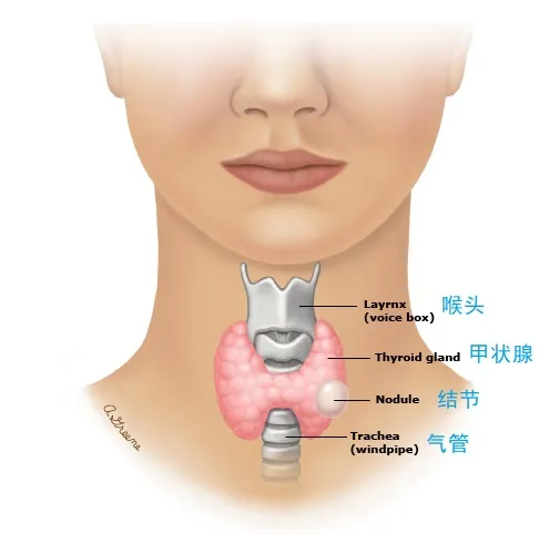 甲状腺脖子上的发动机