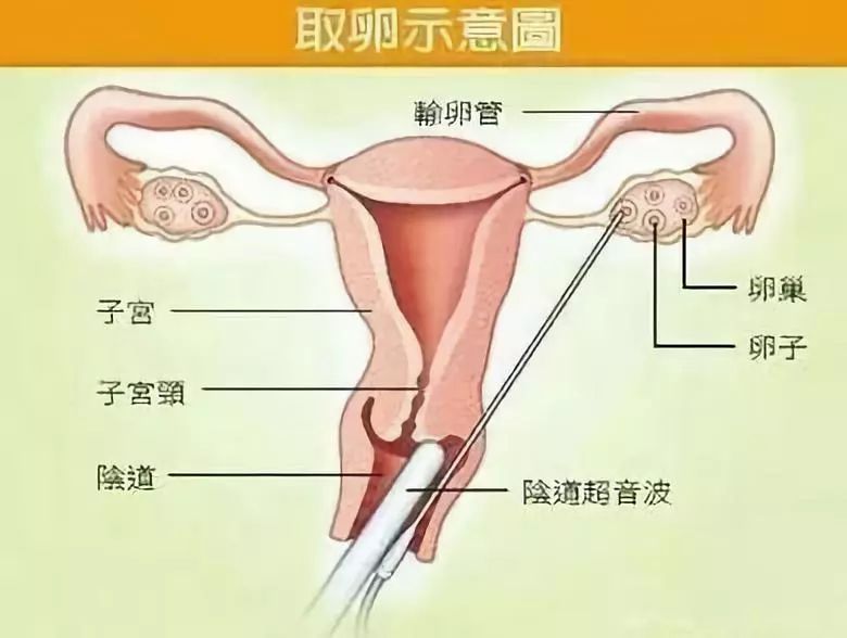 “没有身体接触，五万一次，穿刺下体”：劝你千万别拿健康买虚荣