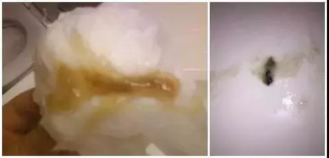 比感冒更严重!宝宝流这种鼻涕,建议尽快就医