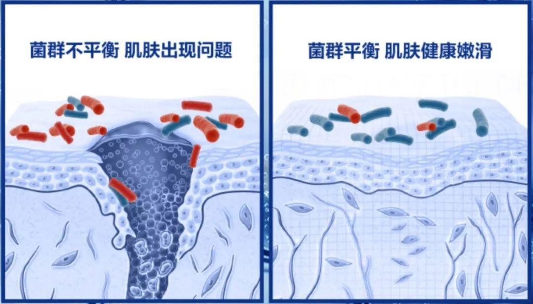 SK-II神仙水和兰蔻小黑瓶怎么选？超详细“成分+使用感”分享