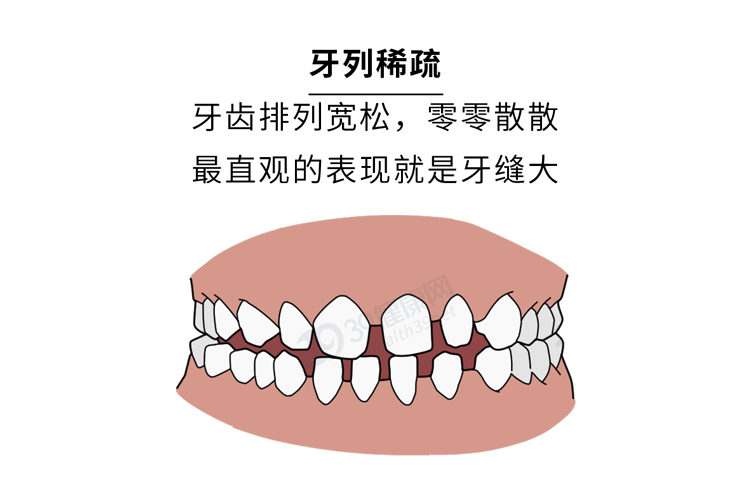 为什么只要戴牙套，牙齿就可以恢复得很整齐？生动展示矫正过程