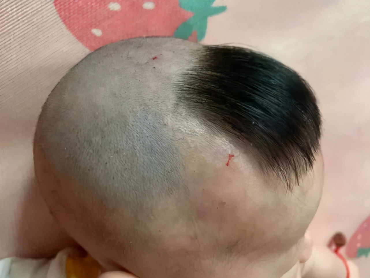 妈妈不顾医生劝阻,给宝宝"剃满月头",半年后孩子发量"感人"