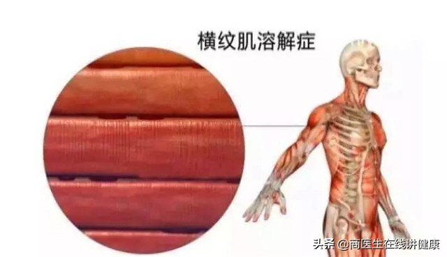 “心肌发动机”：辅酶Q10对心脏有什么好处？
