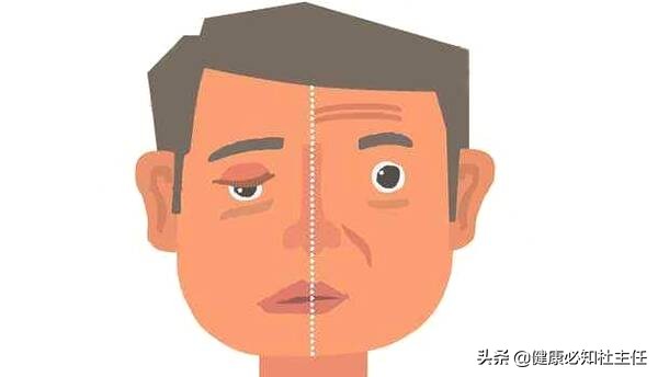 蝎子、黄鳝、蜈蚣、天麻丸这些民间偏方，哪些治疗面瘫又快又好？