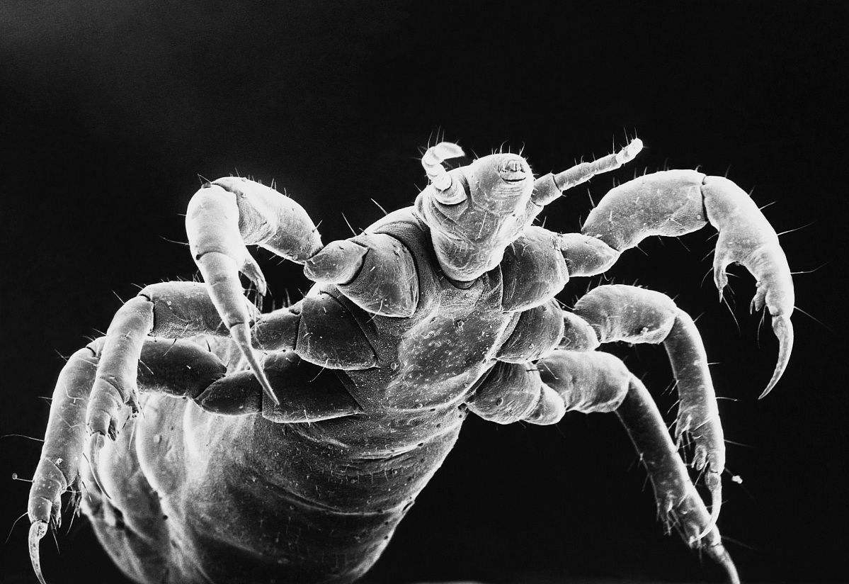 虱子,与人类共进化的寄生虫