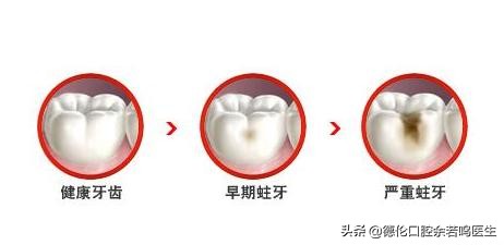 同样是补牙，为什么你去补牙，价格却这么贵？