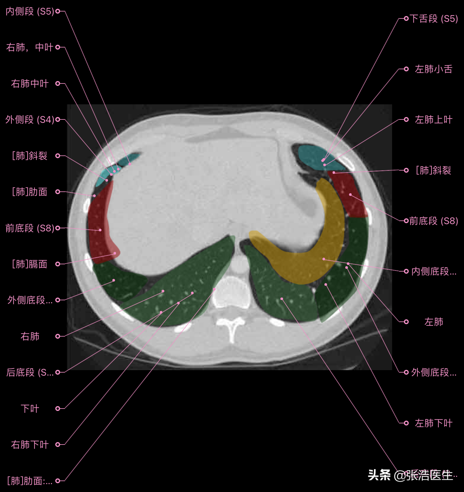 ct扫描定位线解剖图图片