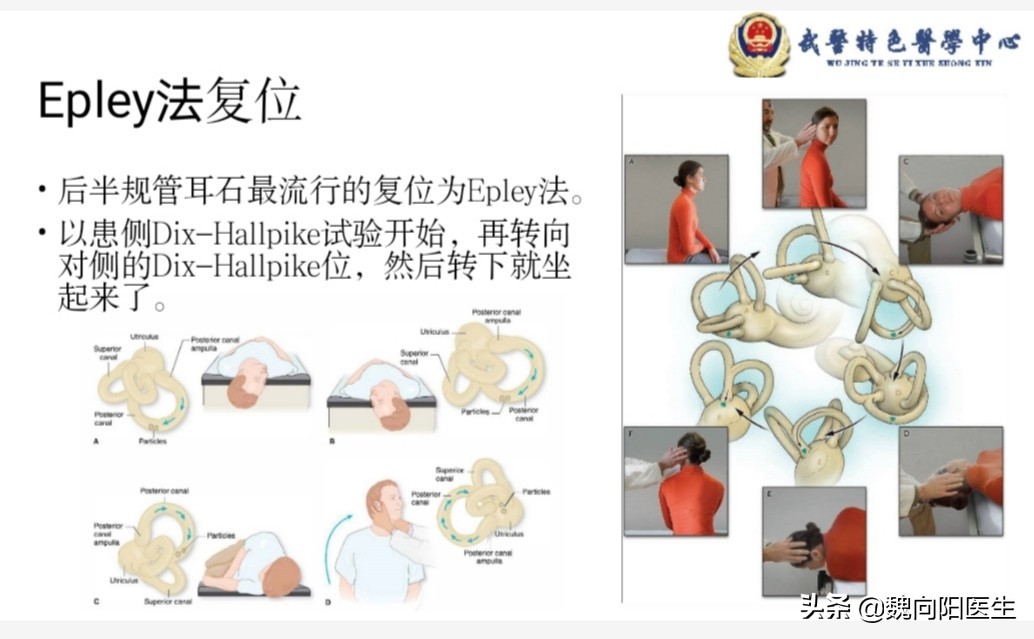 眩晕不要怕，可能是耳石症发作。输液打针不可行，手法复位最有效