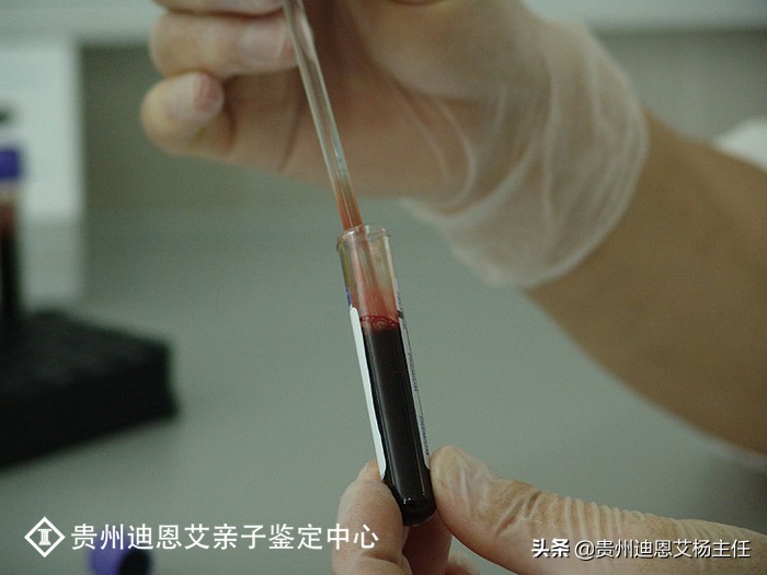 亲子鉴定是怎么做的？（做DNA亲子鉴定的具体流程）