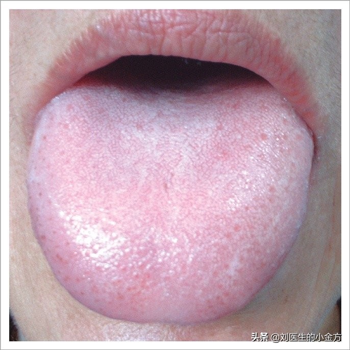 《中医舌诊》,9大体质舌诊图,看看你属于哪种?