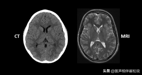 得了病，到底做哪种检查好？X片、CT还是磁共振？