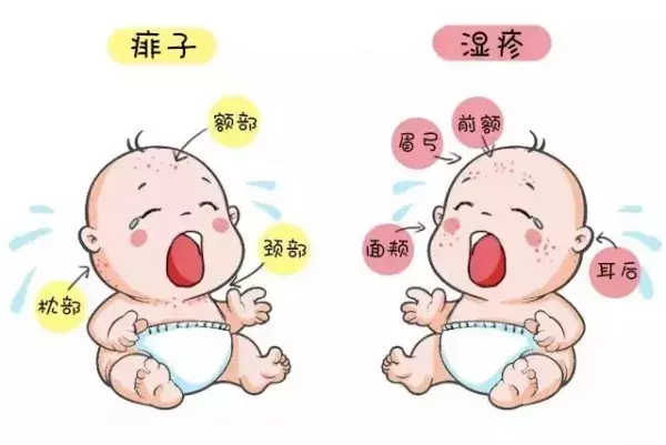 孩子天热起痱子，学会这几招轻松应对！