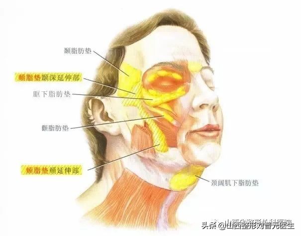 面部吸脂手术，你知道多少秘密？