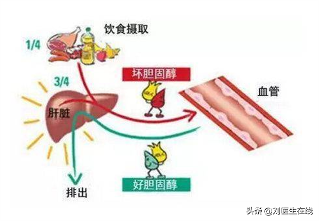 低密度脂蛋白，为什么会高？医生总结：4点主要原因