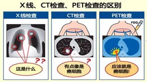 做磁共振有没有辐射？医疗检查能给人体带来多大的辐射？你知道吗