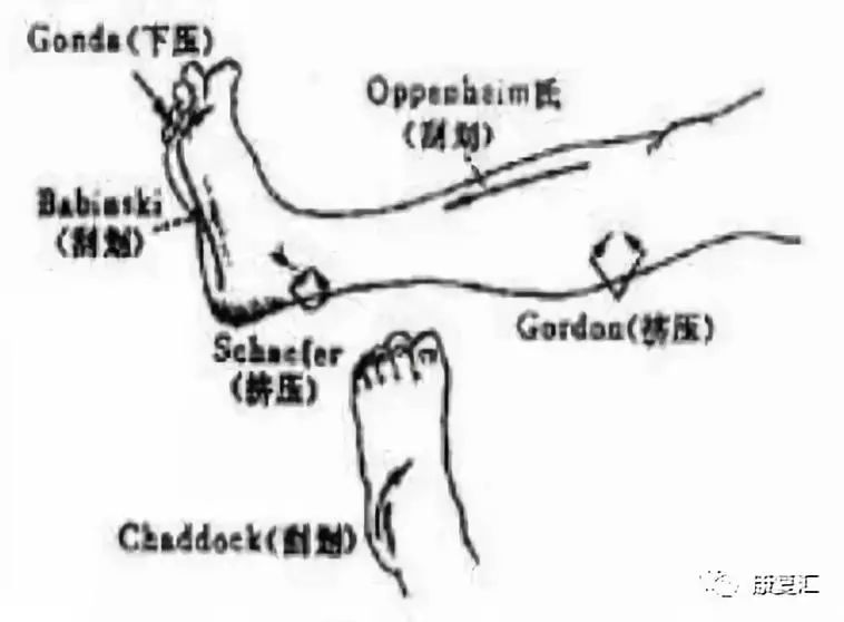 神经系统体格检查神经系统体格检查视频完整版