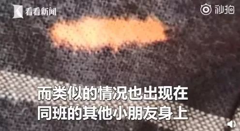 消之宝