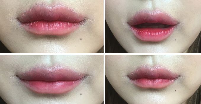 这些项目虽然火，但还是不要做：（3）微笑唇