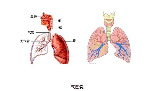 气管炎吃什么好（气管炎患者的饮食建议介绍）