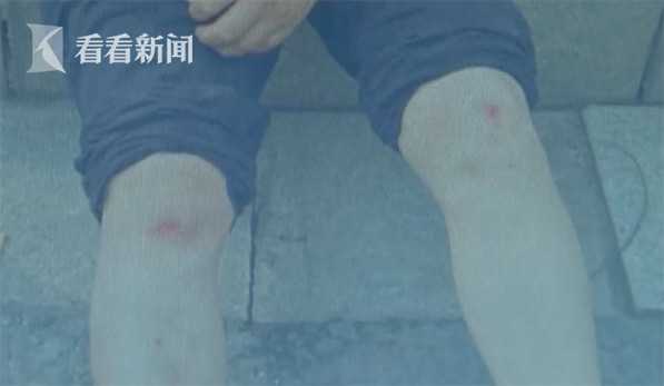 轻微伤一般多少钱私了,轻微伤一般多少钱私了为什么警察局还来抓人