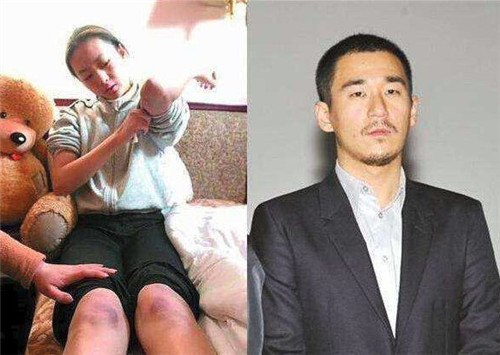 童謠和張默事件詳情，童謠被張默打怎麽回事兩人是什麽關係