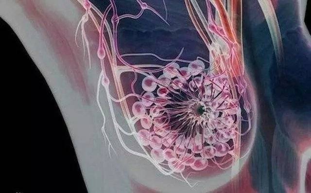 乳腺导管扩张症的形成原因及治疗方法