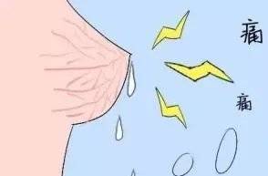 乳腺导管扩张症的形成原因及治疗方法