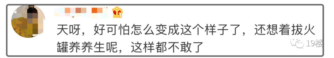 深二度烧伤,深二度烧伤一般多久可以恢复