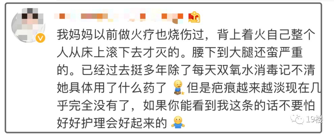 深二度烧伤,深二度烧伤一般多久可以恢复