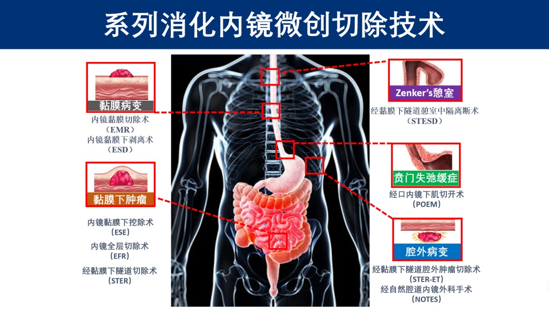 世界杯梅奥诊所(让世界内镜看中国，才是真正的终极目标)