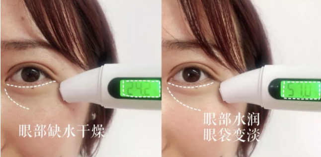 日本蛇毒干细胞眼膜太高科技！眼膜中的“爱马仕”，价格太美丽