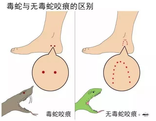 眼镜蛇王(广东惠城区水口惊现14斤眼镜王蛇！不幸被蛇咬，这5件事千万不要做)