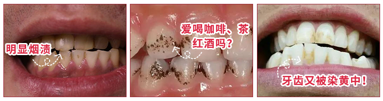 团 | 国货牙膏绝绝子，烟渍茶渍咖啡渍渍渍去除，预防95%未来牙渍，到老“坚白不坏”