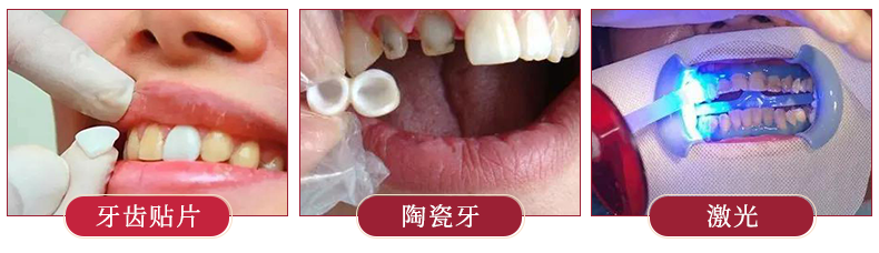 团 | 国货牙膏绝绝子，烟渍茶渍咖啡渍渍渍去除，预防95%未来牙渍，到老“坚白不坏”