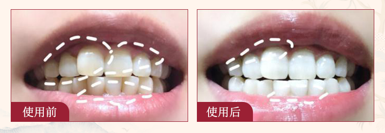 团 | 国货牙膏绝绝子，烟渍茶渍咖啡渍渍渍去除，预防95%未来牙渍，到老“坚白不坏”