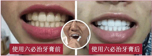 团 | 国货牙膏绝绝子，烟渍茶渍咖啡渍渍渍去除，预防95%未来牙渍，到老“坚白不坏”