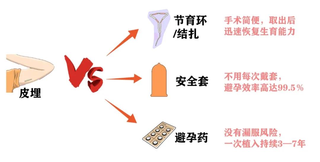 皮下埋植避孕避孕是好方法吗？我猜你还有关于这些副作用的疑问