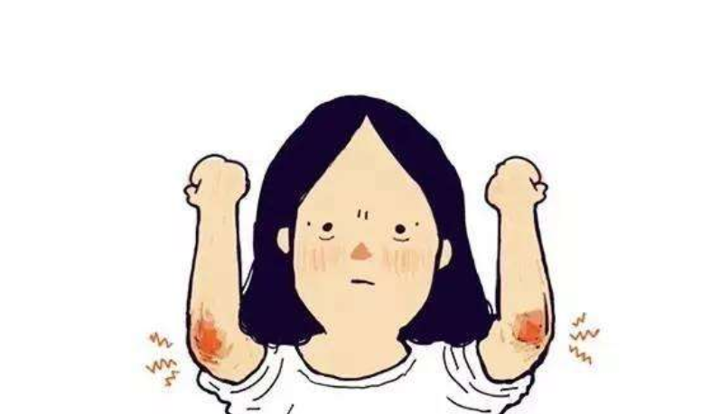 手指关节发黑图片(为什么手肘) - 赤虎壹号