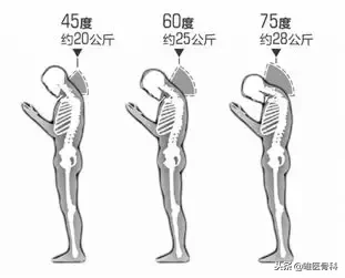 毁气质的 “脖子前倾”,明星也逃不过,医生送你4招拯救!