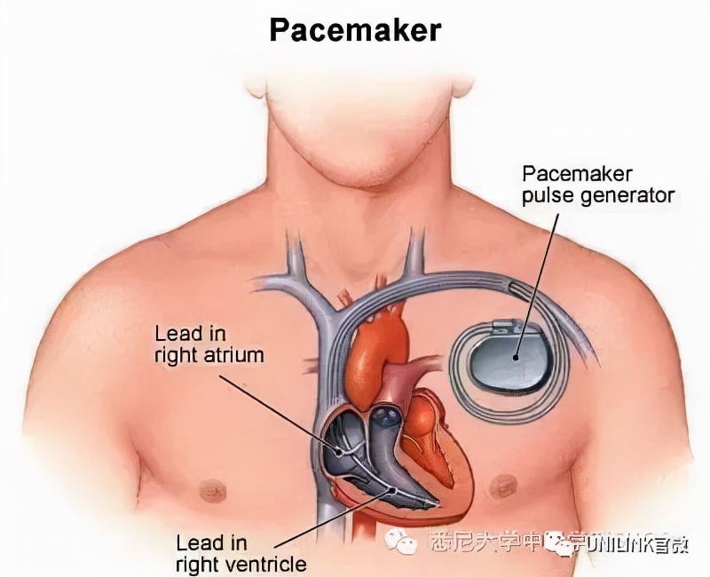 悉尼大学(USYD)2022最全申请攻略