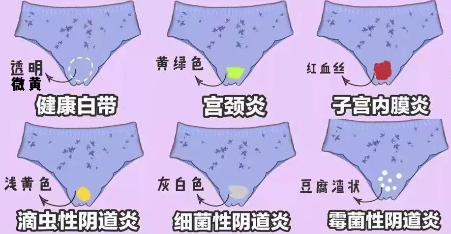 所以当我们发现察觉自己可能是病理性异味,别想其他,先去医院就诊