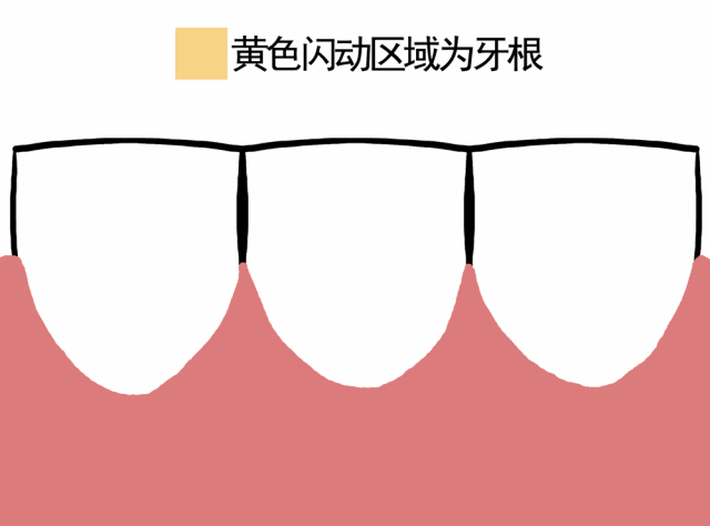医生，我的牙龈萎缩了，能再恢复吗？